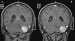 This Image - Fig. 2a-b: Brain MRI
