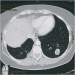 Abb. 1: Thorax-CT