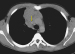 Abb. 2: CT
