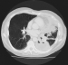 Abb. 1: Thorax-CT