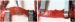 Aktuelles Bild - Abb. 3a-b: Mikroskopische Vasovasostomie
