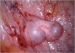 Abb. 1: Spontaneous follicular development
