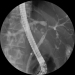 Abb. 3: Cholangitis