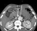 Abb. 2: Plexus coeliacus