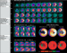 Abb. 1: Stress-Rest-MPS