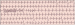 Aktuelles Bild - Abb. 2: Brugada-Syndrom