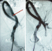 Abb. 3a-b: Iliaca-Aneurysma