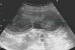 Abb. 1: Sonographie