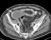 Aktuelles Bild - Abb. 2a: MDCT