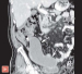 Abb. 2b: MDCT- 3D-Rekonstruktion