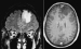 This Image - Fig. 1: Brain MRI
