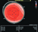 Abb. 7: Strain-Analyse