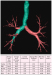 Abb. 4: Computertomographie-COPD