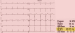 Aktuelles Bild - Abb. 2: AED