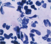 Aktuelles Bild - Abb. 1: Urethritis