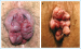 Aktuelles Bild - Abb. 1a-b: Hämorrhoiden