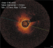 Aktuelles Bild - Abb. 6: In-Stent-Restenose