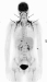 Abb. 1: Braunes Fettgewebe