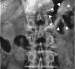 Aktuelles Bild - Abb. 1: Kalkringfigur