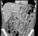 Abb. 2c: D. choledochus