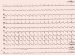 Abb. 1: EKG