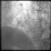 Abb. 10: Film 6