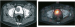 Aktuelles Bild - Abb. 1: Paragangliom-Harnblase