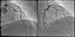 Abb. 9a-b: Angiogramm