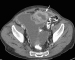 Aktuelles Bild - Abb. 2a: MDCT