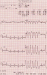 Aktuelles Bild - Abb. 1: Ergometrie