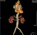 Abb. 3: CT-Angiographie