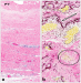 Abb. 5a-b: Histologisches Präparat
