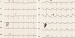Aktuelles Bild - Abb. 1: ECG