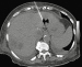 Abb. 4: CT - Leber