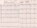 Aktuelles Bild - Abb. 2: Kontroll-EKG