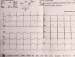 Aktuelles Bild - Abb. 1: EKG - Normofrequenter Sinusrhythmus