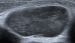 Aktuelles Bild - Abb. 7: Ultraschall-Lymphknoten