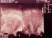 Abb. 1: Myom
