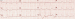Abb. 1: Präklinisches EKG