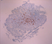 Abb. 3: Immunhistologie
