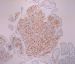 Abb. 5: Immunhistologie
