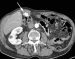 Aktuelles Bild - Abb. 1a: MDCT