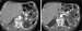 Abb. 1b, c: MDCT