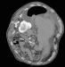 Abb. 2: CT