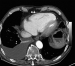 Abb. 3: MDCT - Video