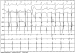 Abb. 2: EKG