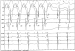 Aktuelles Bild - Abb. 4: EKG