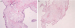 Abb. 4a-b: Histologie