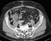 Aktuelles Bild - Abb. 5a: MDCT