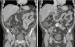 Abb. 5b, c: MDCT